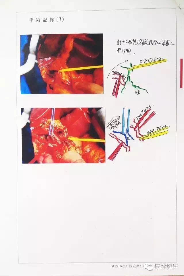 日本手術(shù)記錄