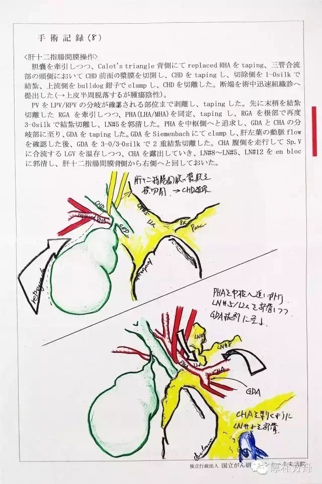 日本手術(shù)記錄