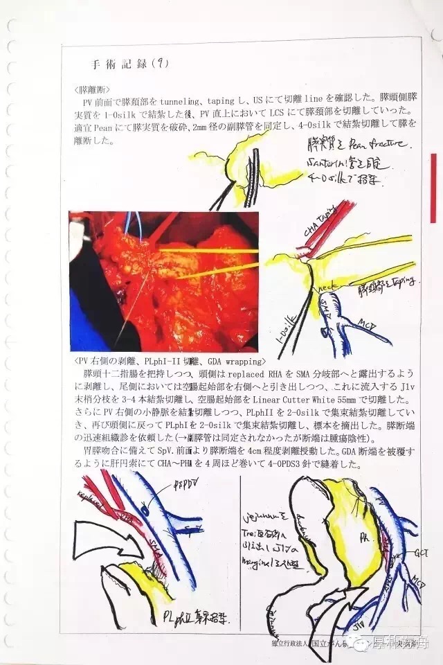 日本手術(shù)記錄