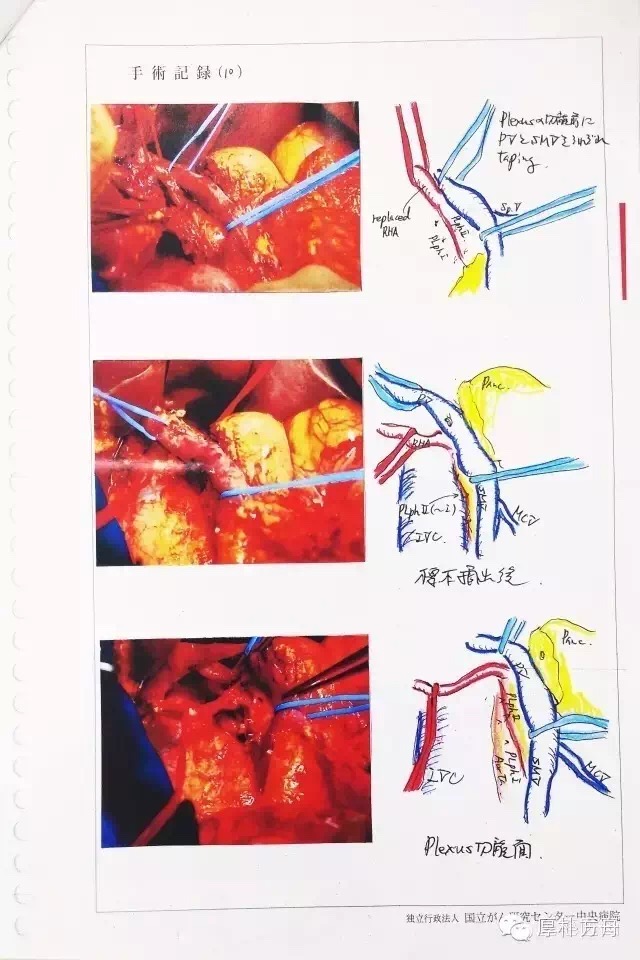 日本手術(shù)記錄