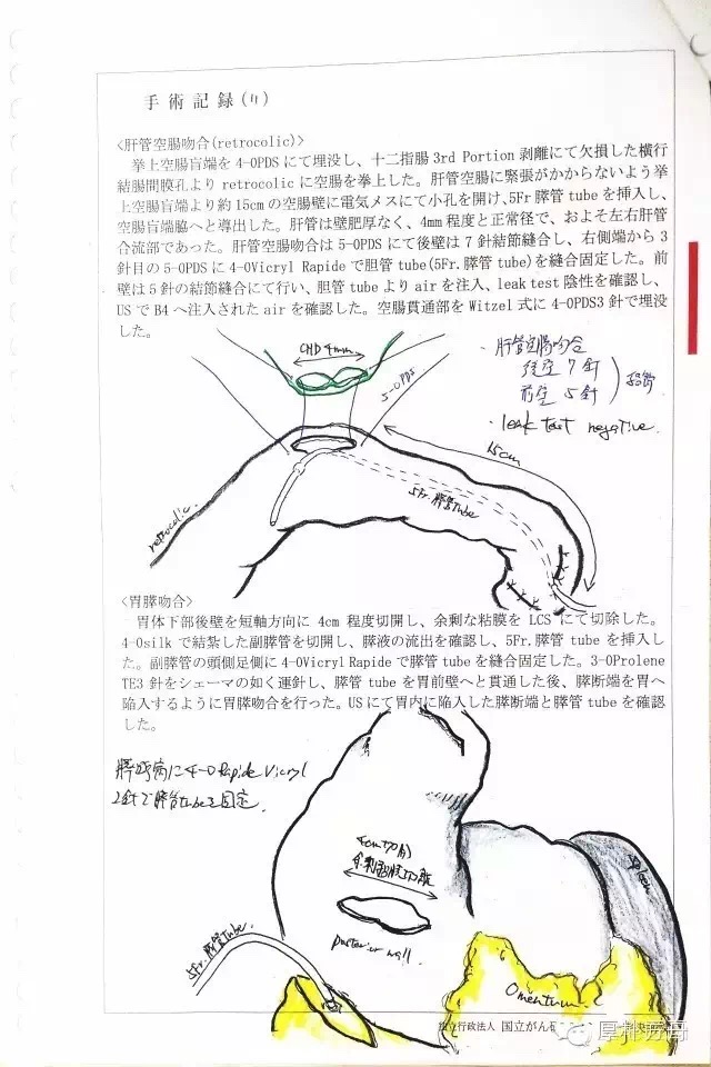 日本手術(shù)記錄