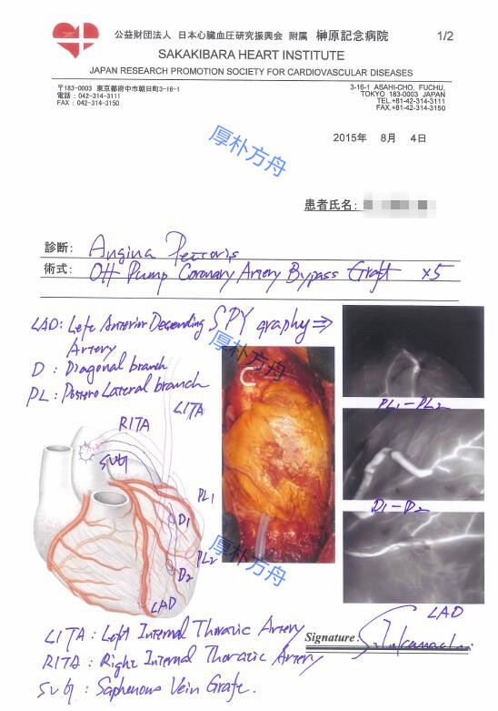 冠心病搭橋手術(shù)方案