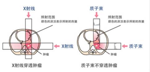 日本質(zhì)子治療