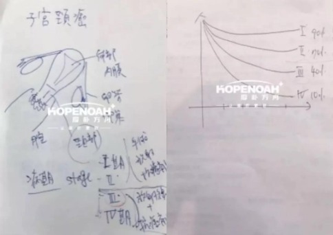 宮頸癌晚期治療方案