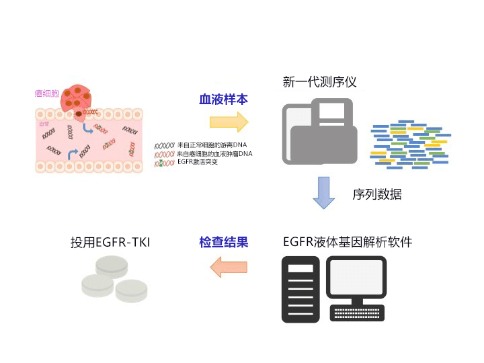 日本開發(fā)出驗血查肺癌基因的高靈敏度技能