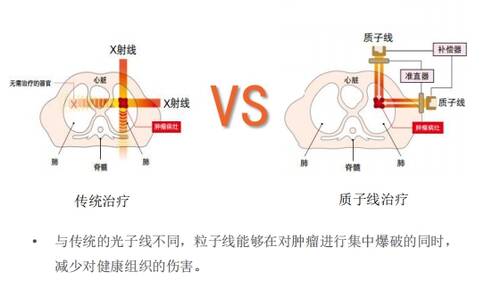 頭頸部肉瘤治療