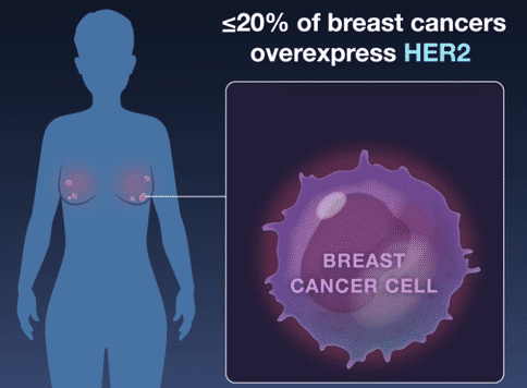 乳腺癌就醫(yī)