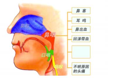 鼻竇癌就醫(yī)