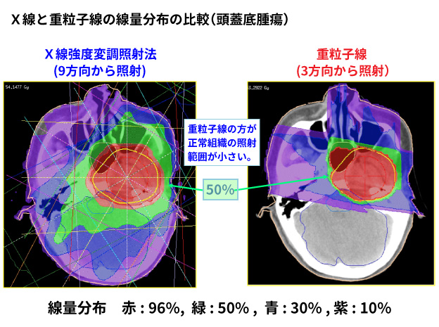 日本QST醫(yī)院