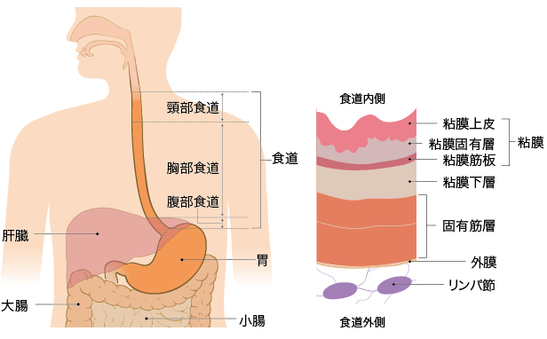 日本食管癌治療