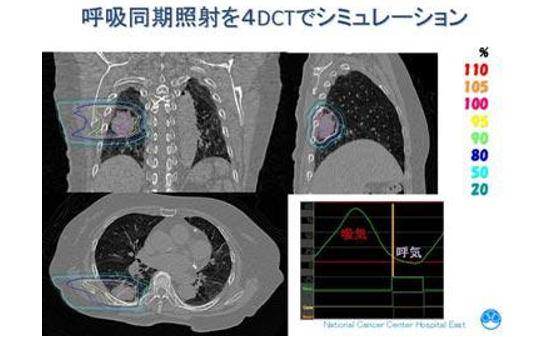 日本質子重離子治療