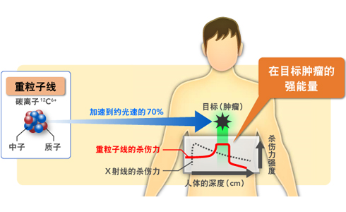 日本重離子治療中心