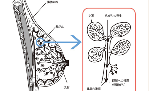 日本治療乳腺癌醫(yī)院排名