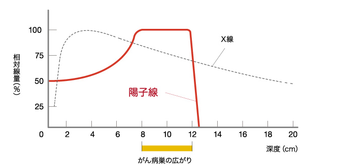 質子治療頭頸癌