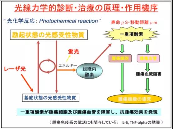 光動(dòng)力治療肺癌等癌癥