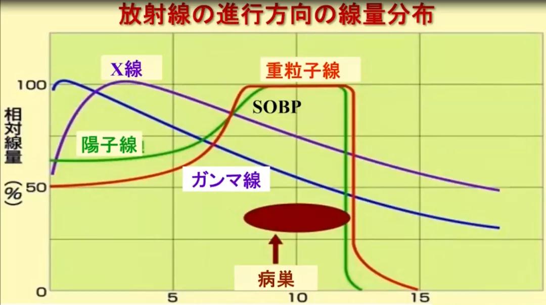 日本質子重離子治療