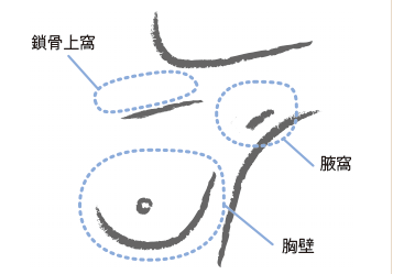 乳腺癌醫(yī)院