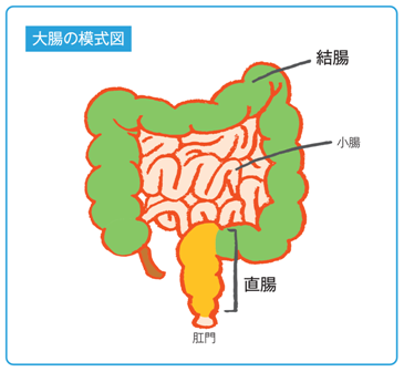 直腸癌