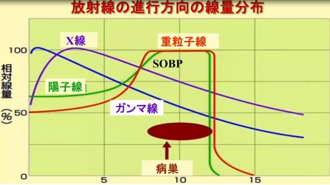 質子重離子治療癌癥