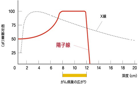 兒童腫瘤質(zhì)子治療醫(yī)院