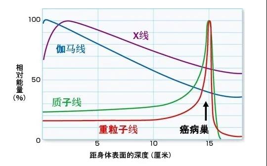 胰腺癌重離子治療