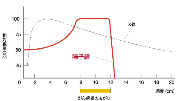 質(zhì)子重離子原理