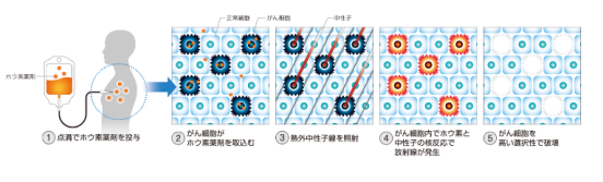 日本頭頸部腫瘤治療